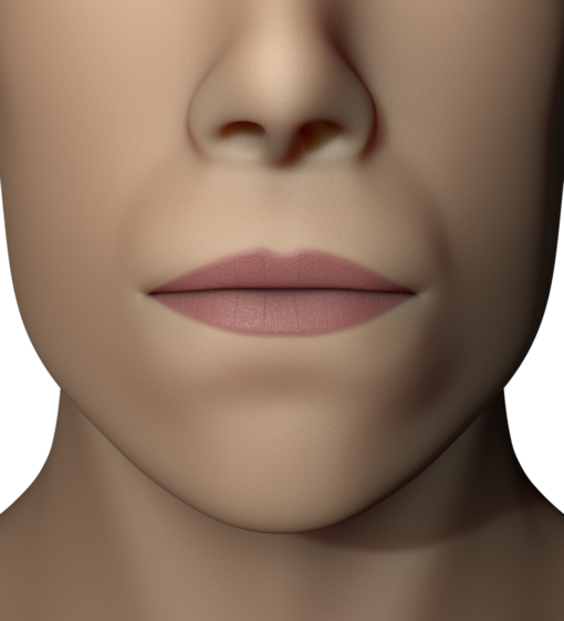 Myobrace For Brackets B1 Ling – Image 7