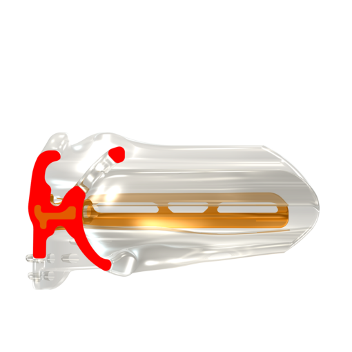 Myobrace For Brackets B2 – Image 3