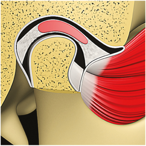 TMJ – Image 5