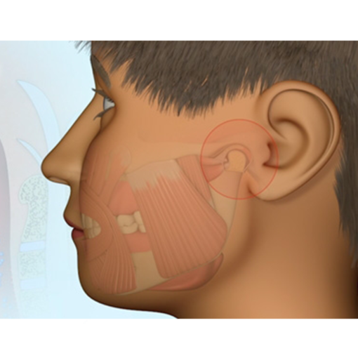 Myobrace For Kids K0 – Image 4