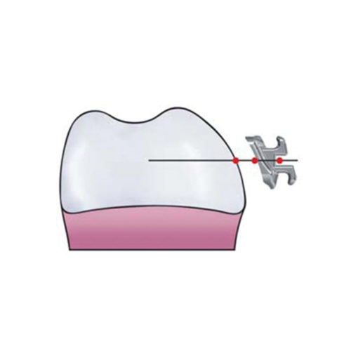 Bracket metal mustang – Image 4