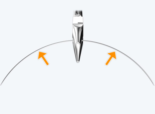 The Farrell Bent Wire System™ (BWS) – Image 3